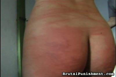 Welts A-Plenty